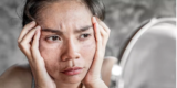 Can Makeup Cause Skin Problems, and How Can I Prevent Them?